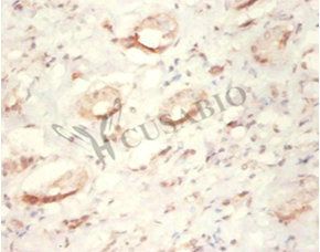 YARS Antibody