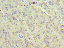 U2AF1 Antibody