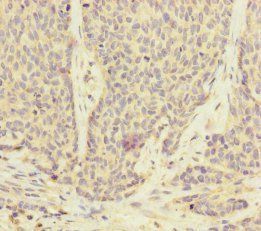 UACA Antibody