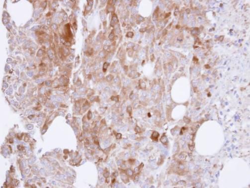 UAP1 antibody [N1C3]