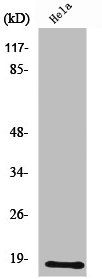UBE2D2 Antibody