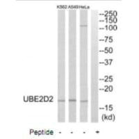 UBE2D2 Antibody