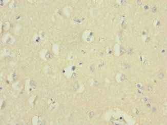 UBE2F Antibody