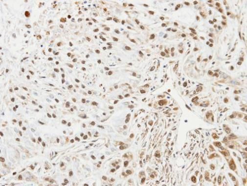 UBE2L3 antibody