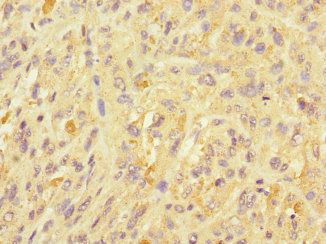 UBE2S Antibody