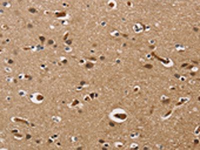 UBE2S Antibody