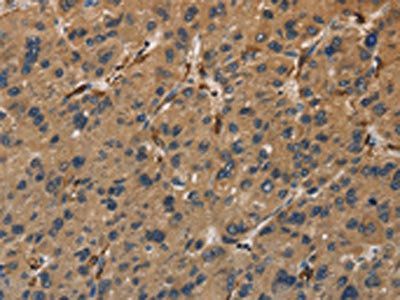 UBE2S Antibody