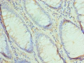 UBE2V2 Antibody