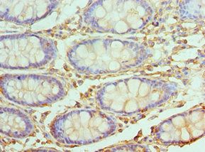UBE2V2 Antibody
