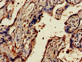 UBE2V2 Antibody