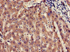 UBE2V2 Antibody