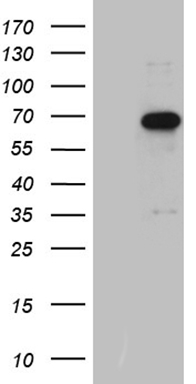 UBE3B Antibody