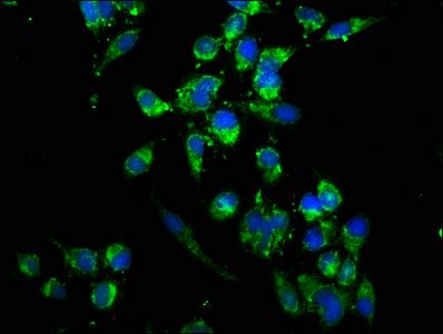 UBE2K Antibody
