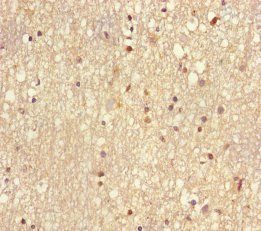 UBE2V2 Antibody