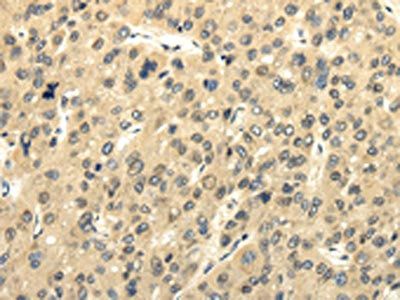 UHRF1BP1 Antibody