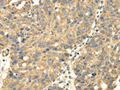 UHRF1BP1 Antibody