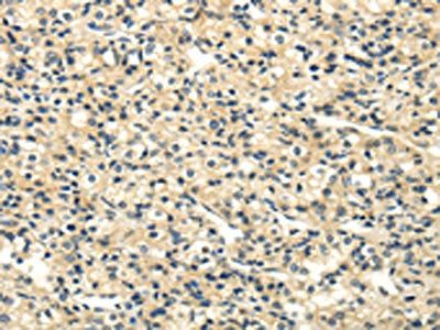 UHRF1BP1 Antibody