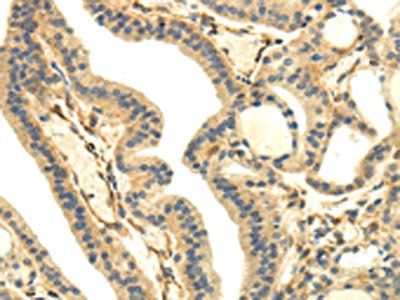 UHRF1BP1 Antibody