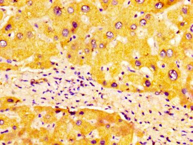 ULBP1 Antibody
