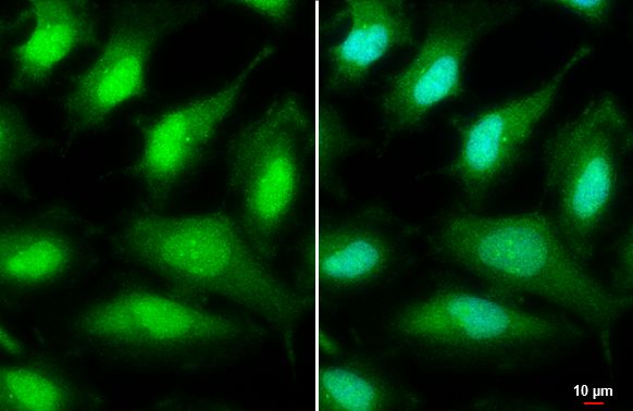 ULK2 antibody [C2C3], C-term