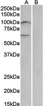 UNC5B (aa629-643) Antibody