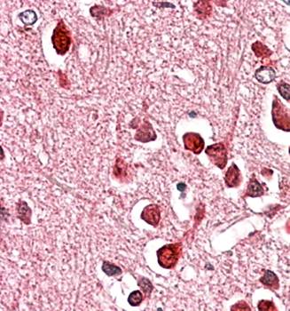 UNC5C Antibody