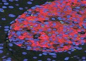 UNC5C Antibody