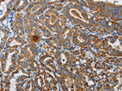 UPF1 Antibody