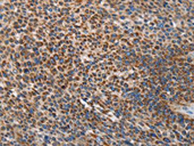 UPF1 Antibody