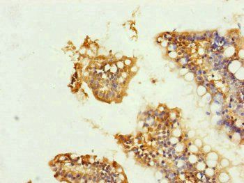 UQCRC1 Antibody