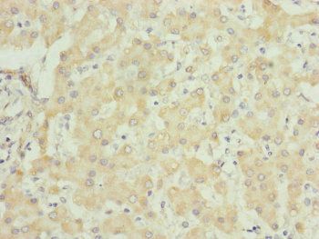 UQCRC1 Antibody