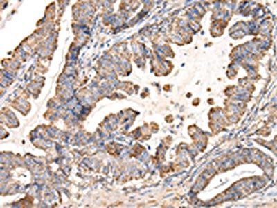 UQCRC1 Antibody