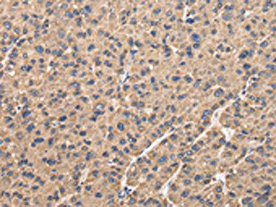 UQCRC1 Antibody