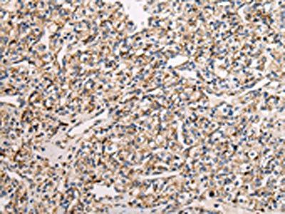 UQCRC1 Antibody