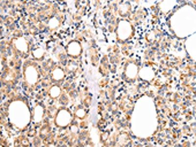 UQCRC1 Antibody