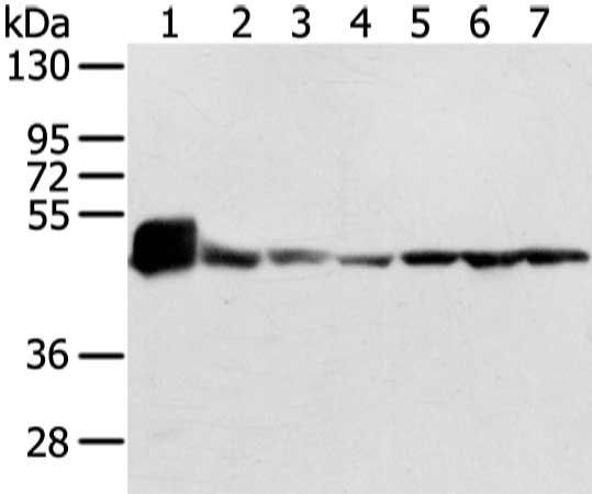 UQCRC1 Antibody