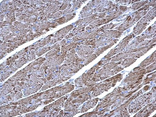 UQCRC1 antibody [N1N3]