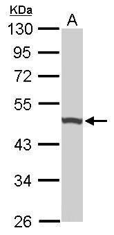 UQCRC1 antibody [N1N3]