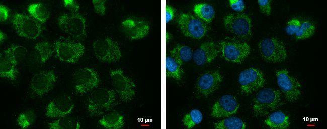 UQCRFS1 antibody [N1C3]