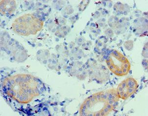 UTS2 Antibody