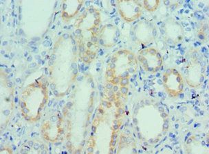 UTS2 Antibody