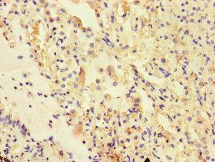 UVRAG Antibody