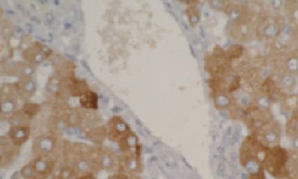 Mouse anti Human Cytochrome P450 2A6