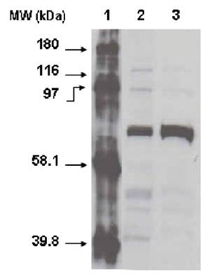 Mouse anti Human Cytochrome P450 4F11