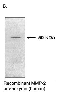 Mouse anti Human Matrix Metalloproteinase 2 (MMP2)