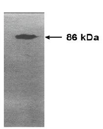 Mouse anti Human Matrix Metalloproteinase 9 (MMP9)