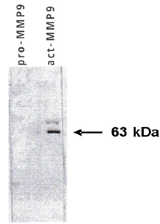 Mouse anti Human Matrix Metalloproteinase 9 (MMP9)