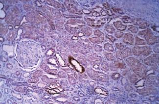 Rabbit anti Human Sphingomyelin Synthase 2