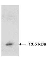 Mouse anti Human Tissue Inhibitor of Matrix Metalloproteinase 2 (TIMP2)