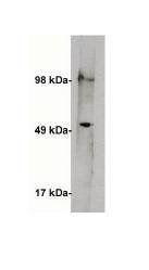 Rabbit anti Human Serine Palmitoyltransferase 1